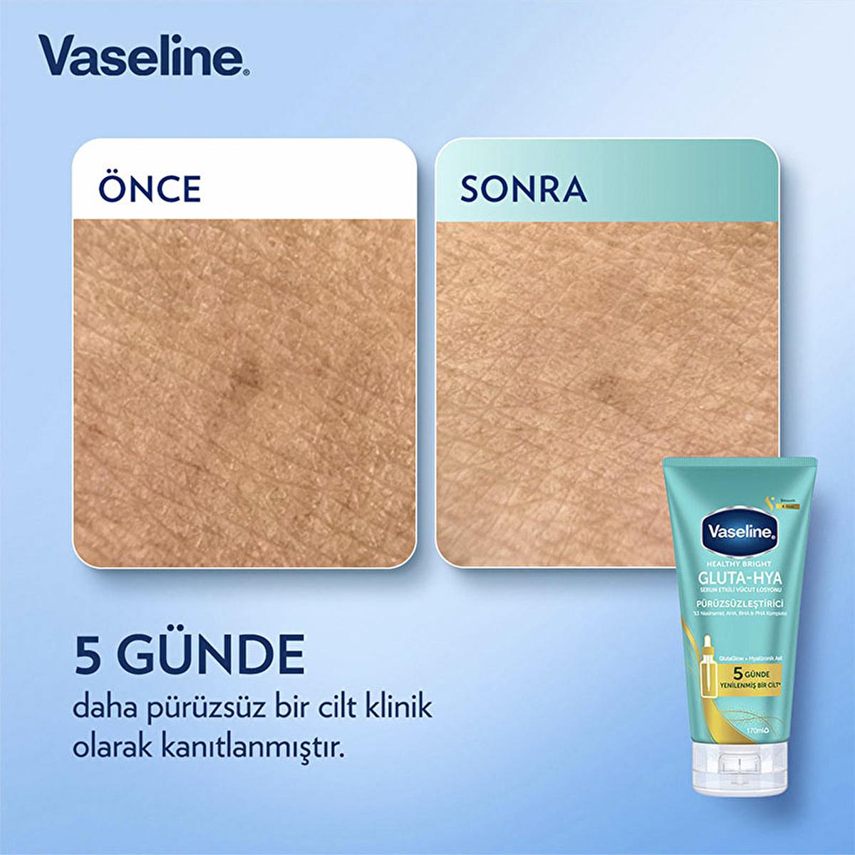 Vaseline Gluta-Hya Smooth Body Lotion: Brighten, Smooth, & Hydrate Dry Skin | Niacinamide, AHA, BHA, PHA, Hyaluronic Acid - Non-Greasy Formula