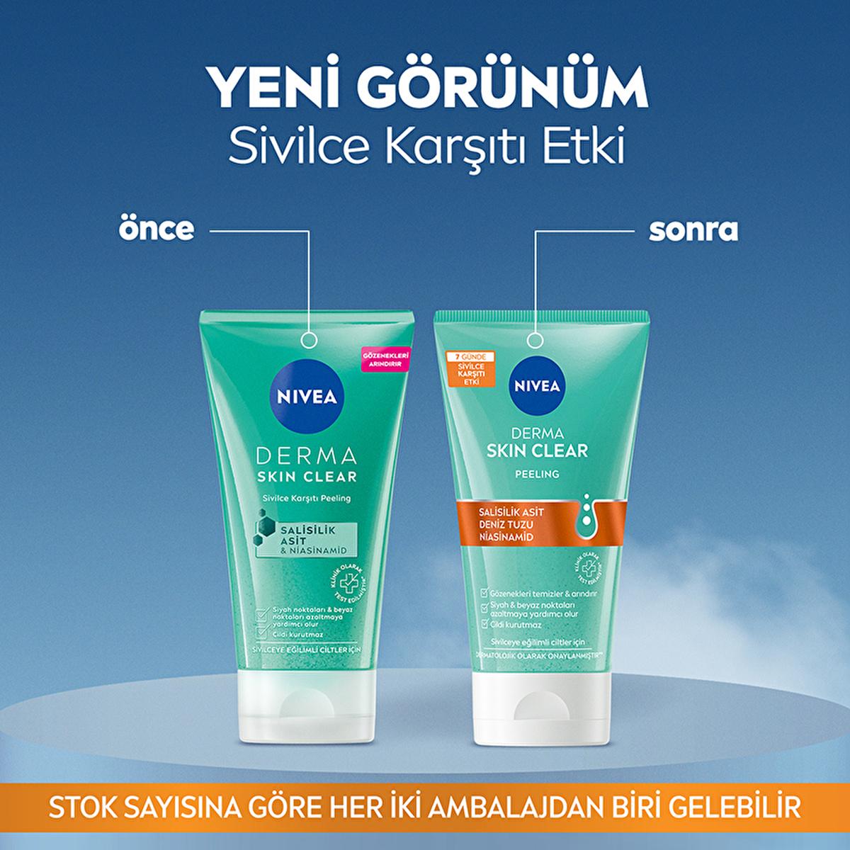 Nivea Derma Skin Clear Acne Fighting Face Peeling - Deep Cleansing, Exfoliant for Acne Prone Skin
