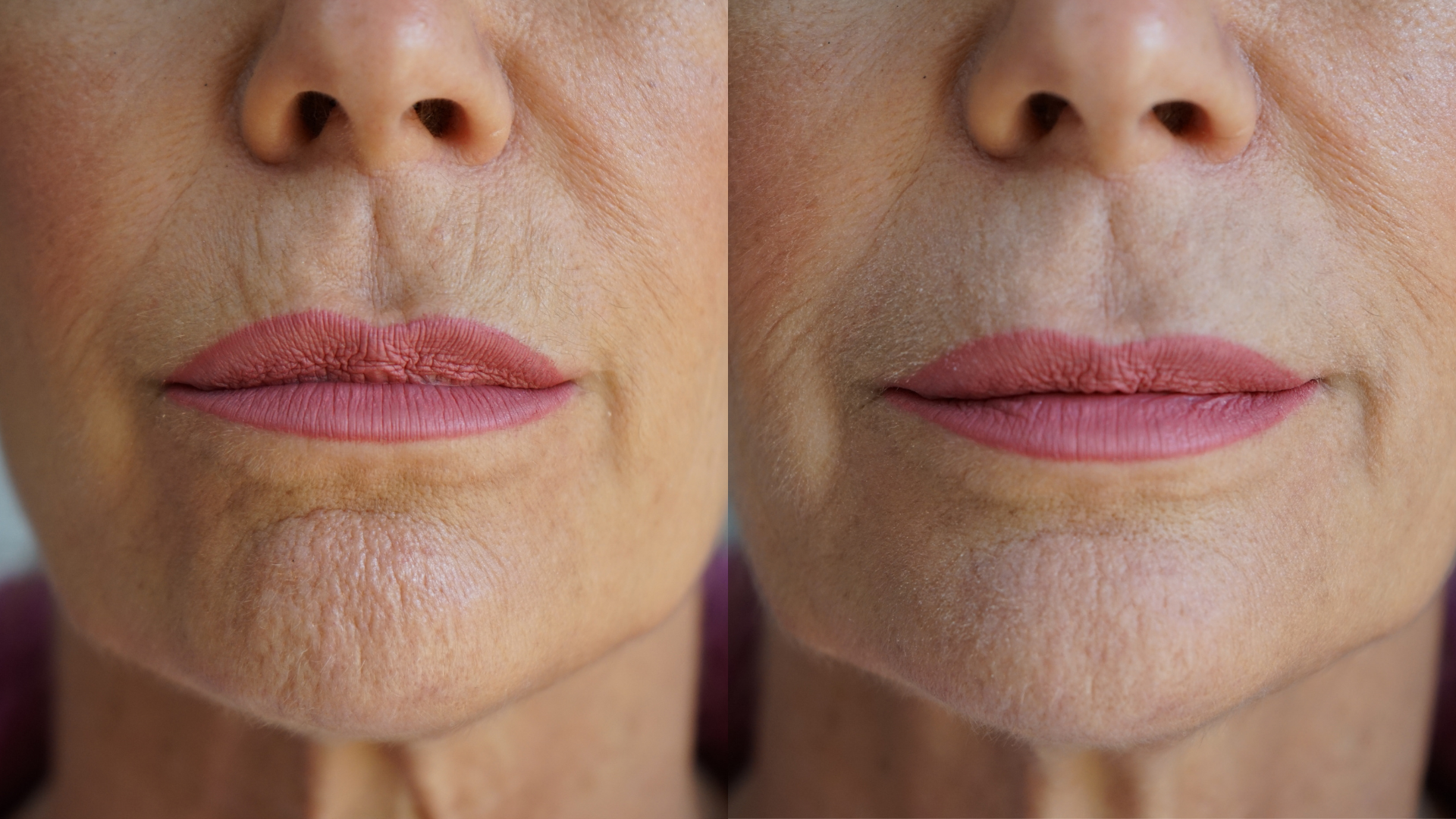 PRAI Beauty Ageless Lip & Line Filler — alternative angle