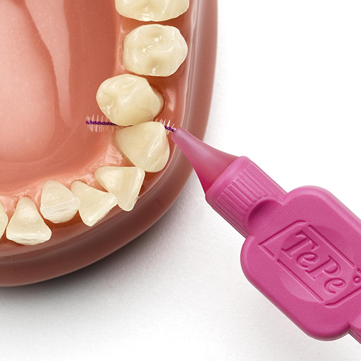 Tepe Interdental Brush 0.4 mm - Effective Oral Care for Dental Implants & Bridges