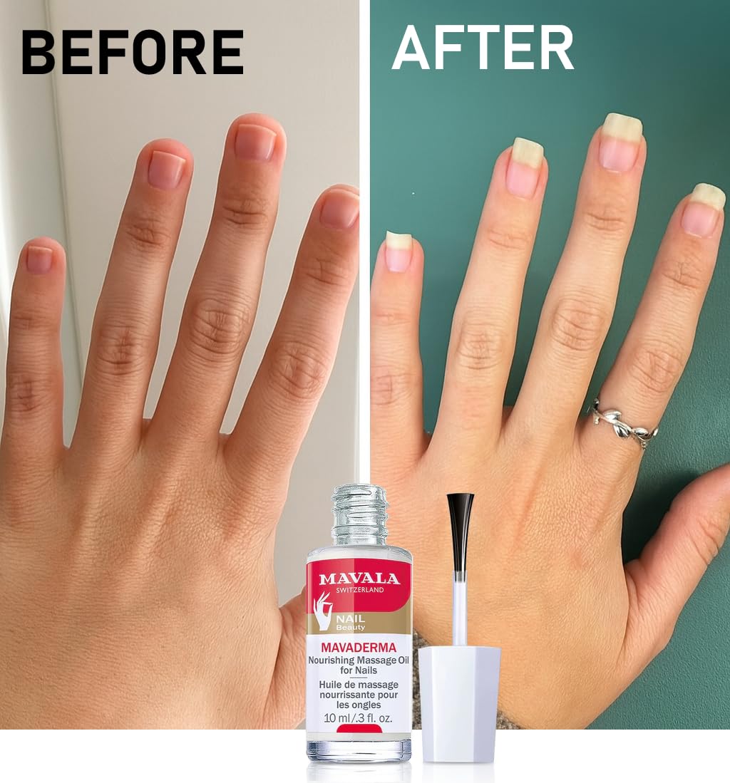 Mavala Mavaderma Massage Oil For Nails - Nourishing Nail Care Oil for Healthy Growth (10ml)