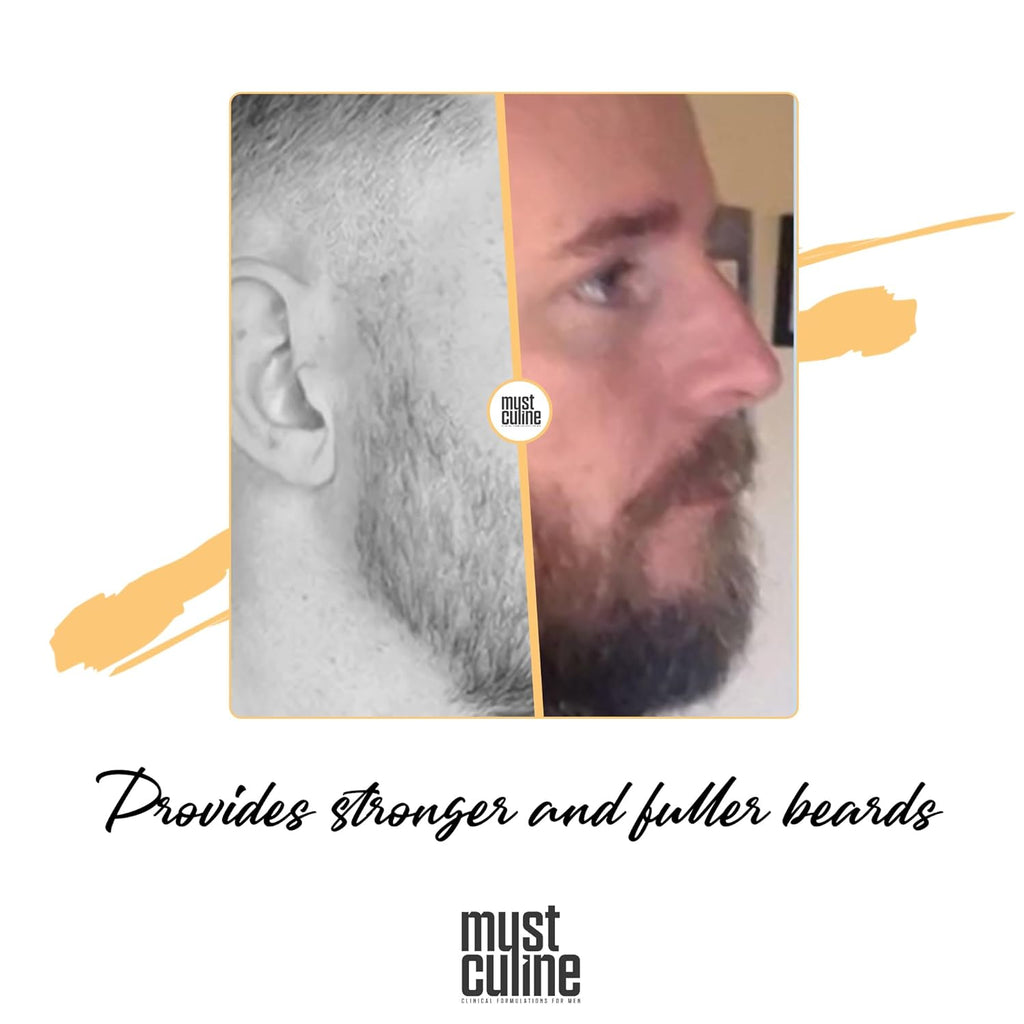 Mustculine Beard Growth Kit for Men