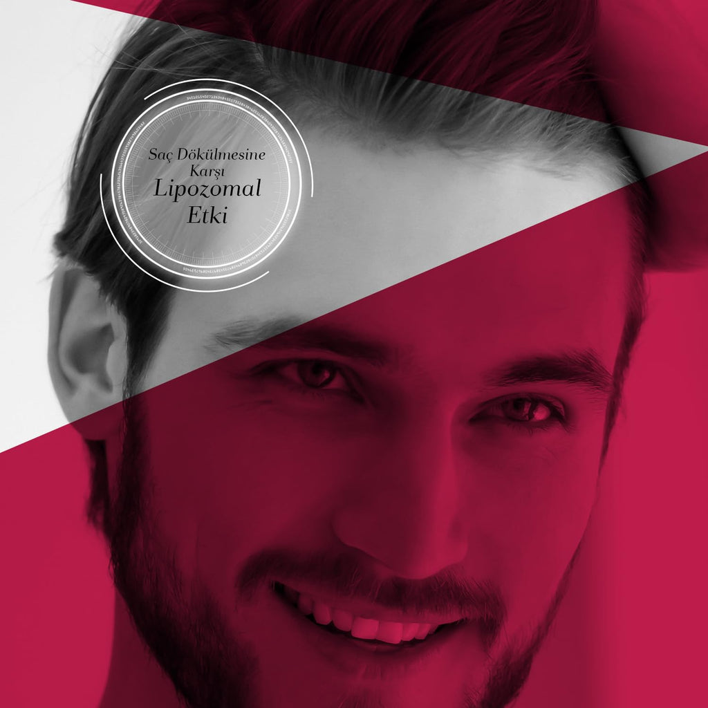 Bioxcin Forte Shampoo - Fight Hair Loss | 300 ml