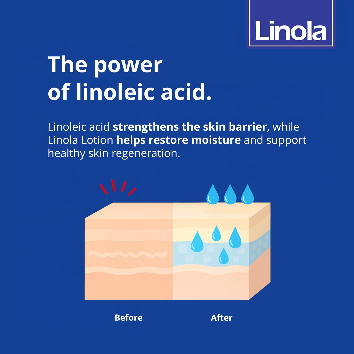 Linola Lotion - Daily Skin Care Solution | 200 ml