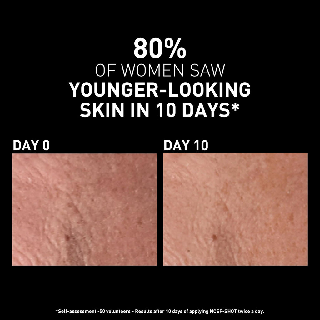 Filorga Skincare Serum - Revitalizing NCEF-Shot Concentrate for Smoother, Firmer Skin - Anti-aging Luxury Skincare Product