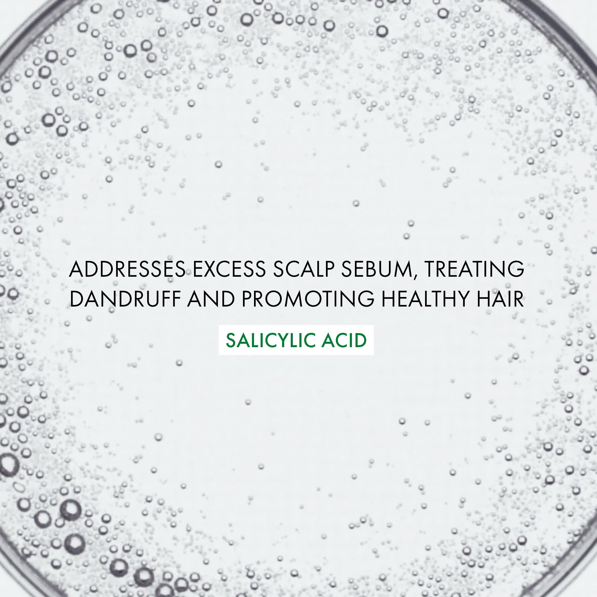 Vichy Dercos Anti-Dandruff Shampoo for Sensitive Scalps - Gentle, Effective Treatment - 200ml