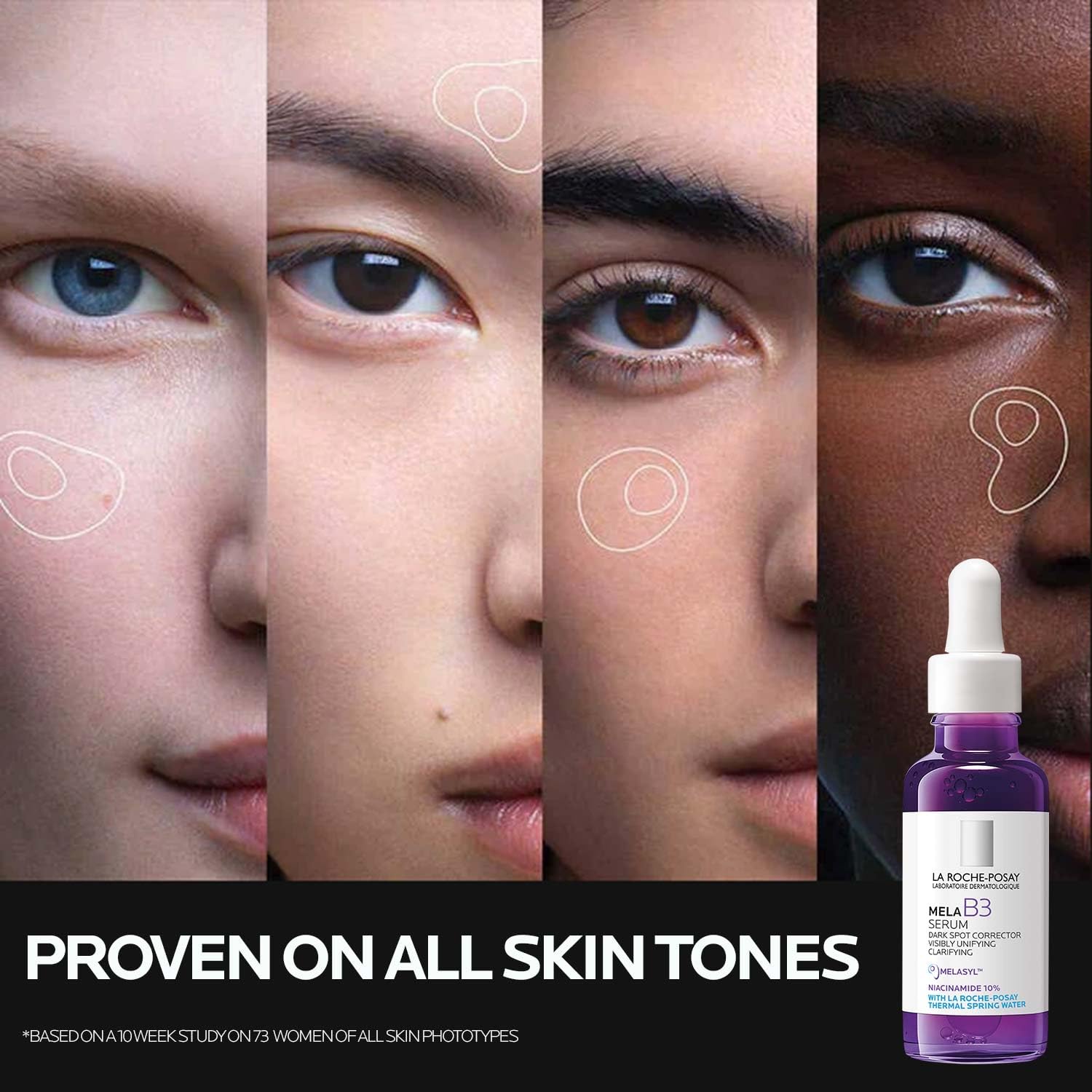 La Roche Posay Anti-Dark Spot Serum Mela B3 10 - 30ml, Dermatologically Tested Skincare for Hyperpigmentation Treatment