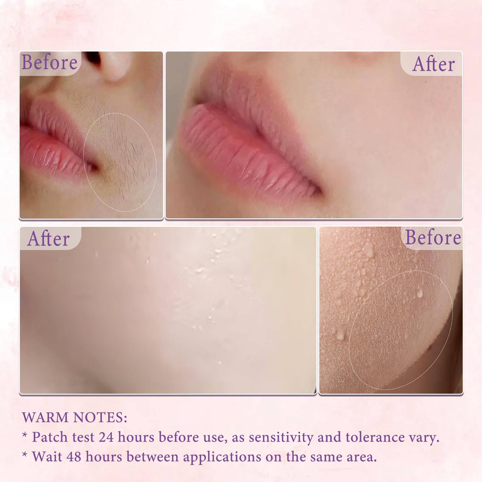 Remove Care Hair Removal Cream Sensitive Skin - 200ml | Fast-Acting
