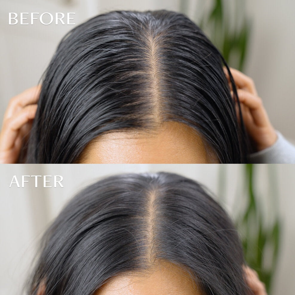 m'Chel Haircare Day After™ Brush + Refill Bundle Clean Dry Shampoo — alternative angle
