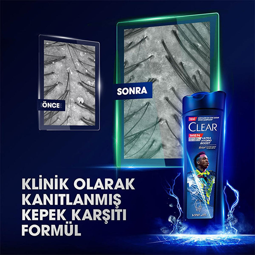 Clear Men Vin’cius Jœnior Anti-Dandruff Shampoo: Ultra Hydro Boost for Men - 10x Deeply Moisturizing, Eucalyptus & Cedarwood, Fight Dry Scalp & Flakes