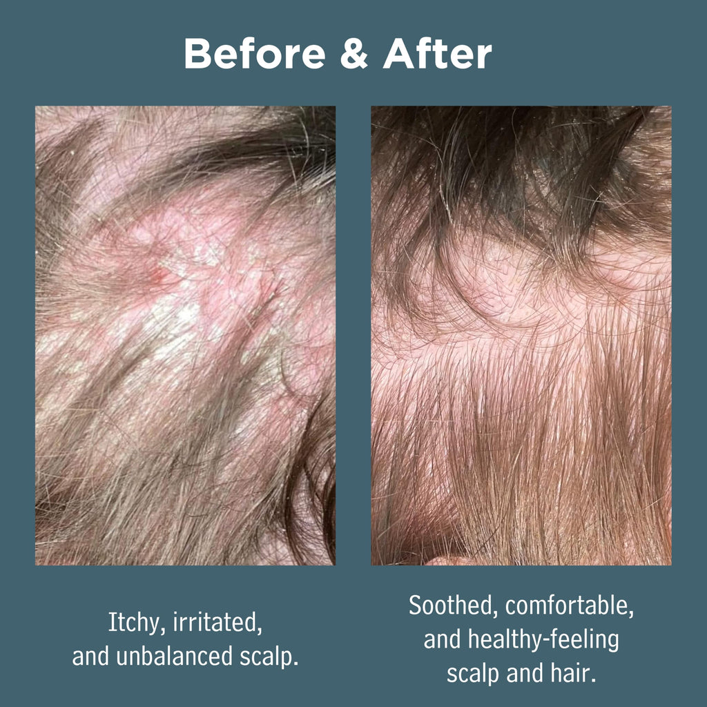 Dead Sea Spa Magik Hair Conditioner - Moisturizing, Natural, Organic Hair Care with Dead Sea Minerals & Coconut Oil
