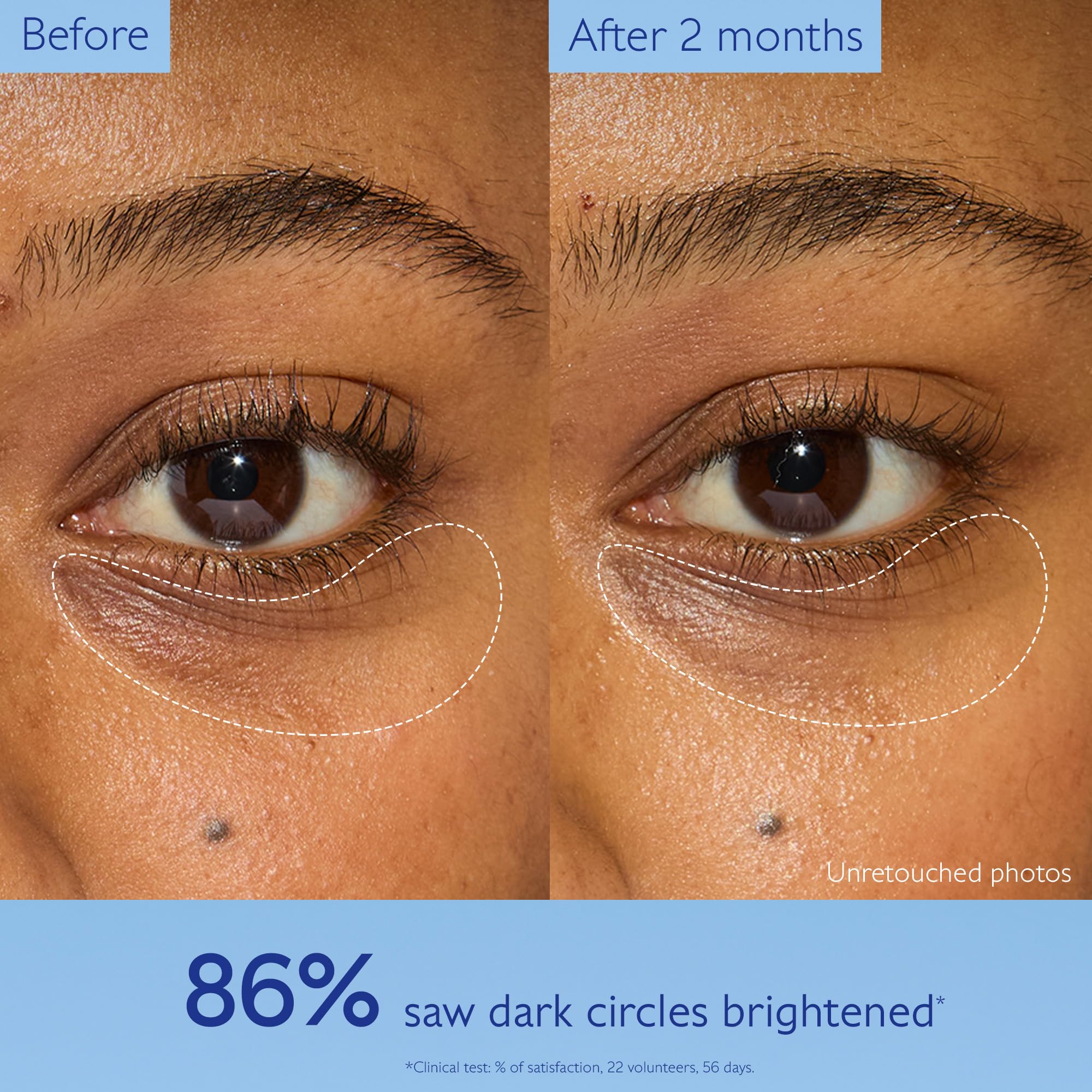 Caudalie Vinoperfect Brightening Eye Cream - Dark Circle Treatment & Anti-aging Eye Care