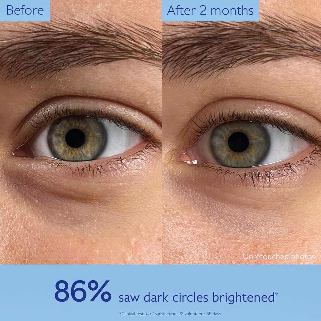 Caudalie Vinoperfect Brightening Eye Cream - Dark Circle Treatment & Anti-aging Eye Care