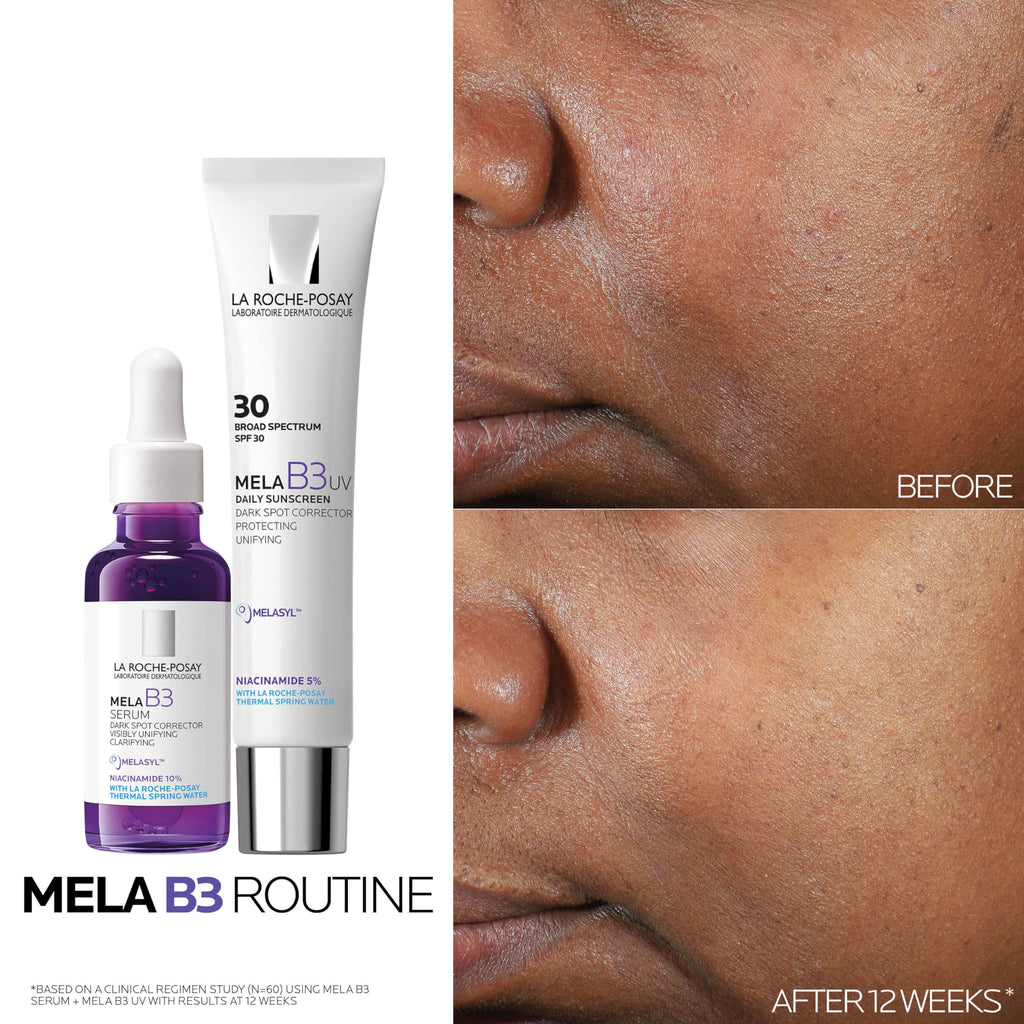 La Roche Posay Anti-Dark Spot Serum Mela B3 10 - 30ml, Dermatologically Tested Skincare for Hyperpigmentation Treatment