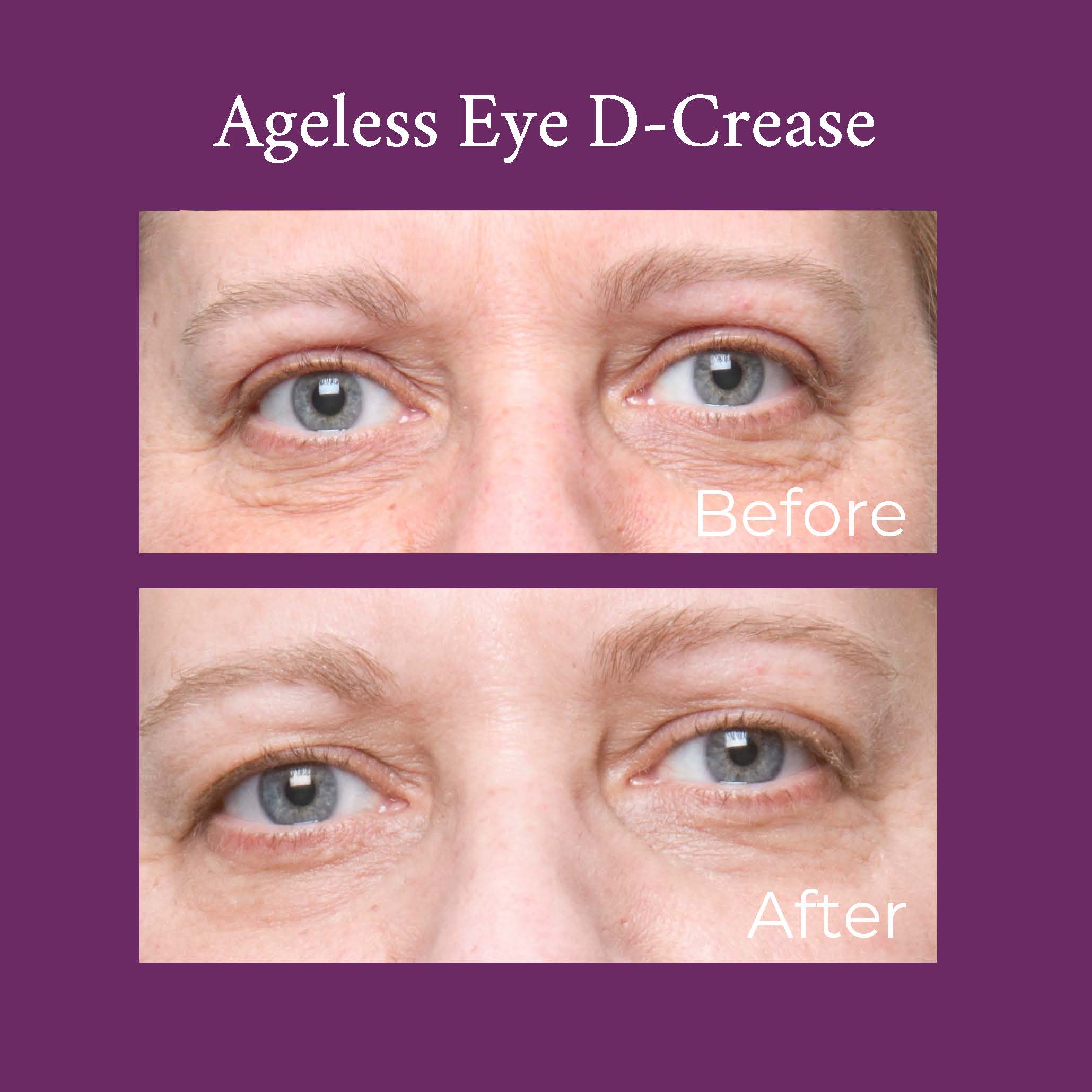 PRAI Beauty Ageless Eye D-Crease — lifestyle context
