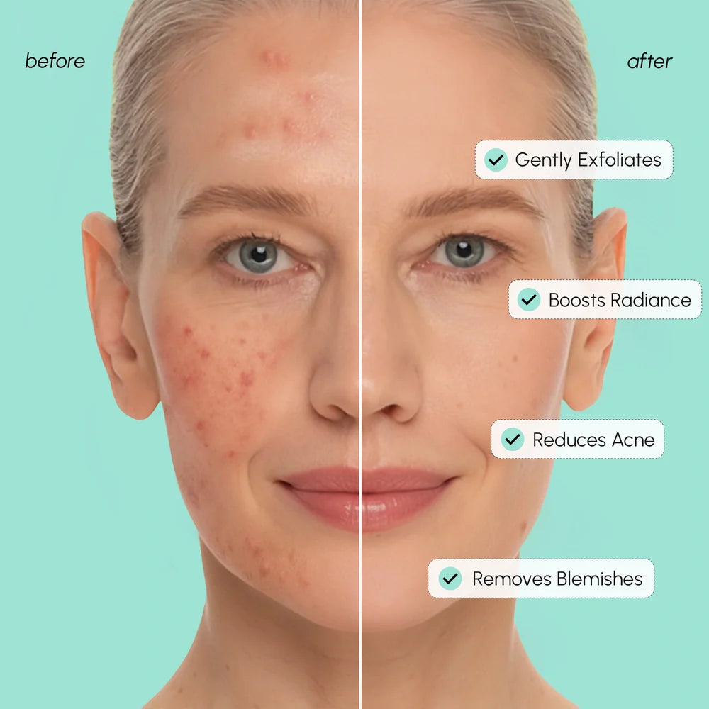 Maree Azelaic Acid Soothing Pads — Maree branding close-up
