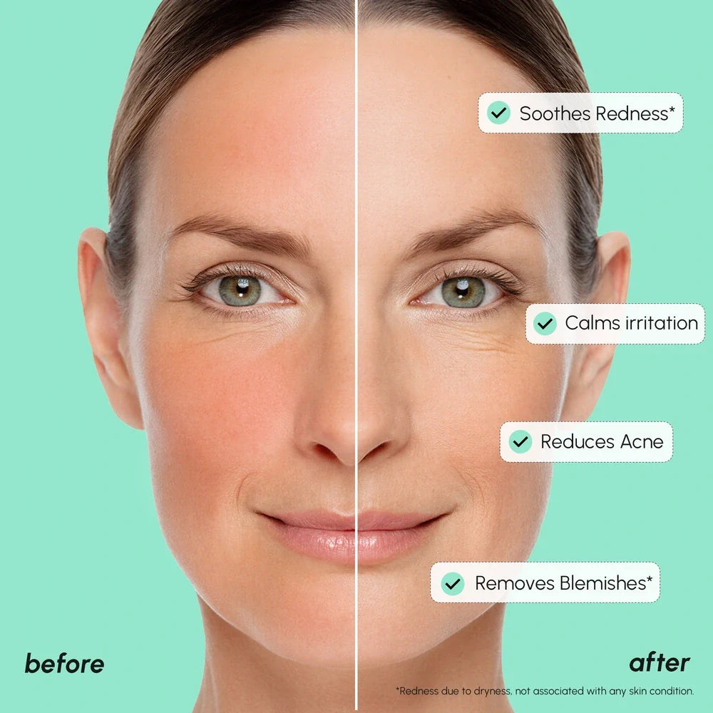 Maree Redness Soothing Azelaic Acid Serum — side view