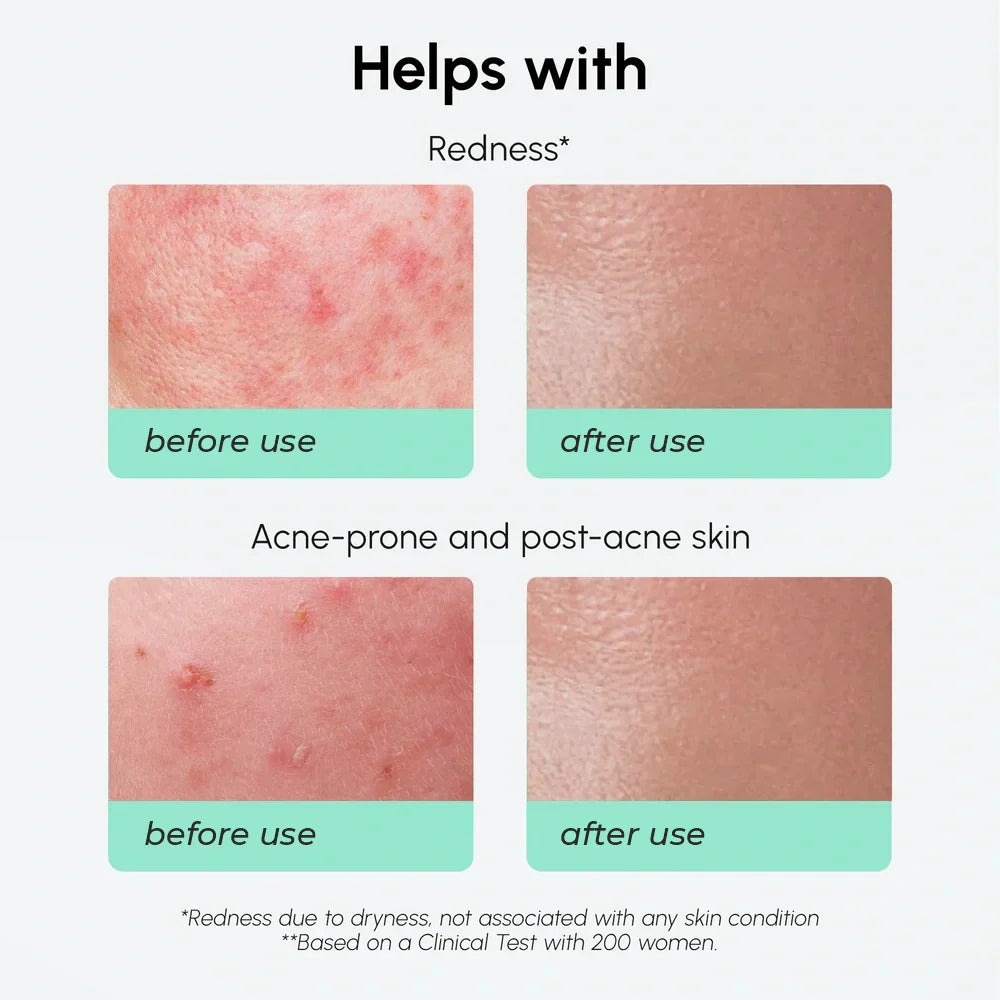 Maree Redness Soothing Azelaic Acid Serum — back view