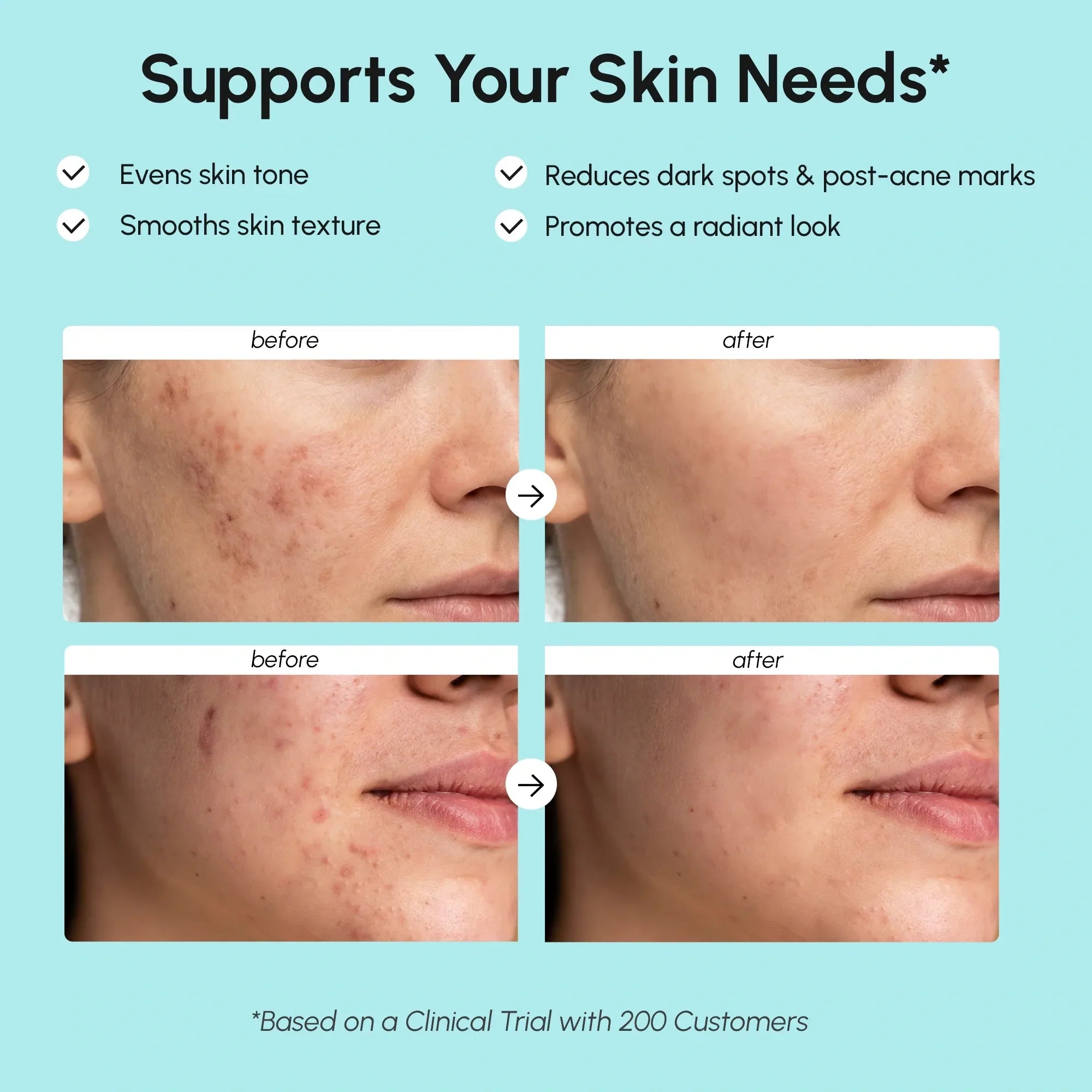 Azelaic Acid Cream for Sensitive Skin — view 3