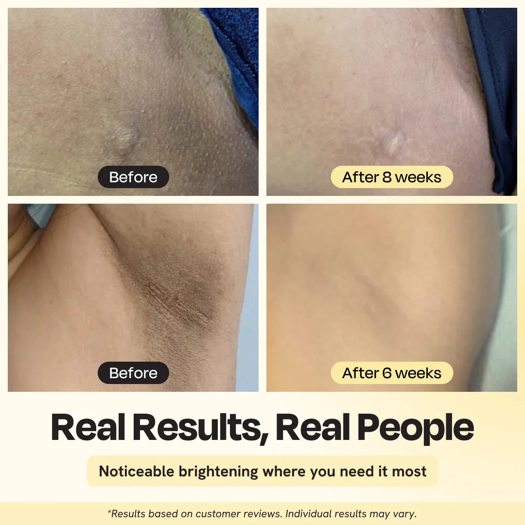 Gleamin Illuminating Intimate Serum — brightening serum for shaving + ingrown hair discoloration