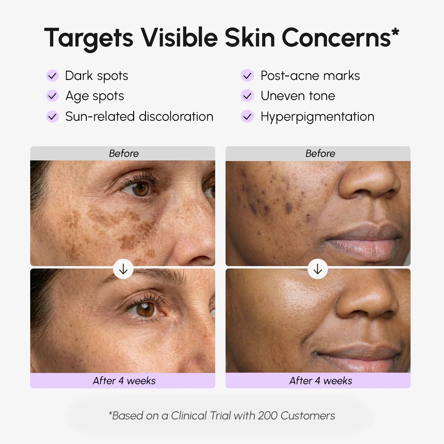 Maree Face & Body Serum for Dark Spots — lifestyle context