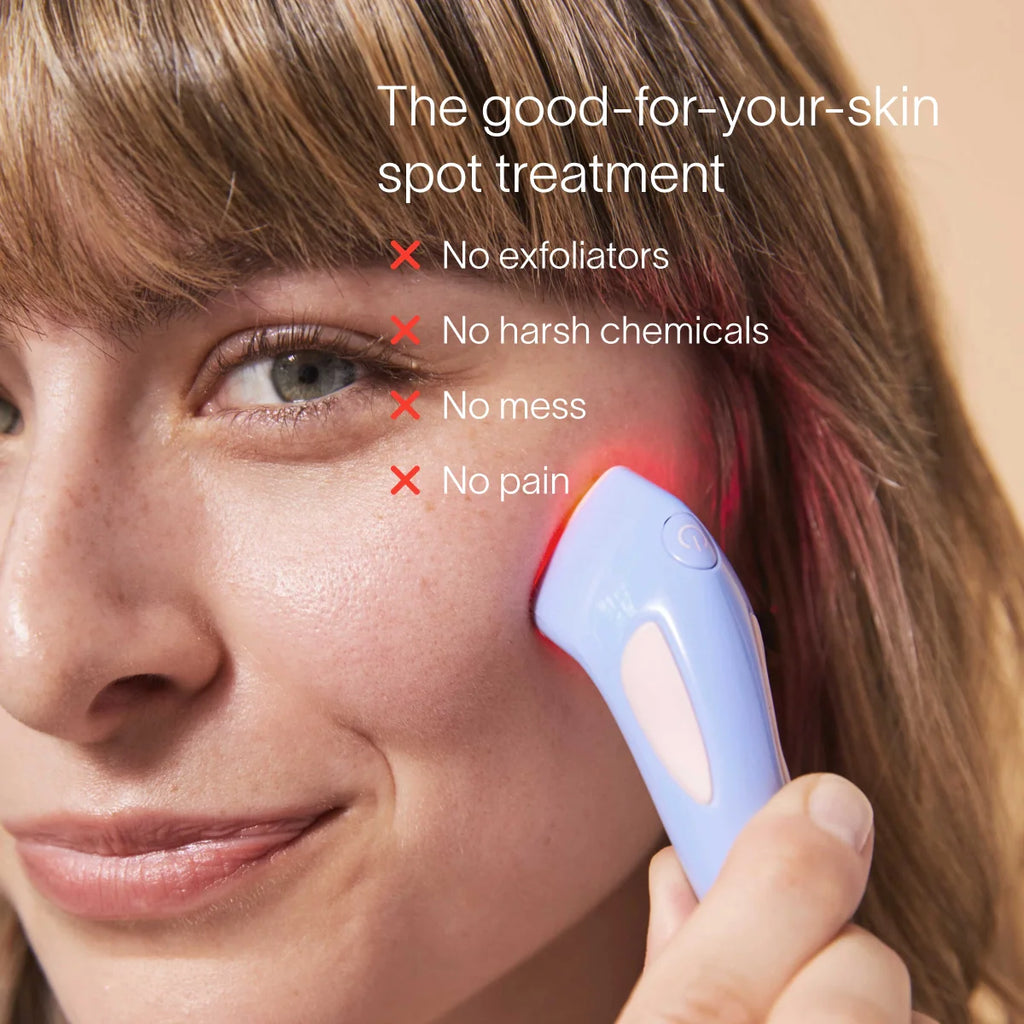 Bye Acne: 3-Minute Pimple Spot Treatment – Solawave, view 3