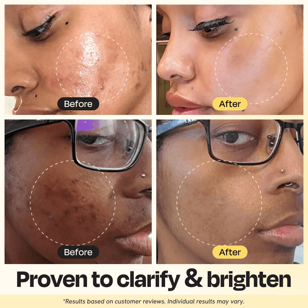 Gleamin Vitamin C Clay Mask — kakadu plum ingredient detail