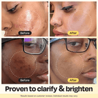 Gleamin Vitamin C Clay Mask — kakadu plum ingredient detail