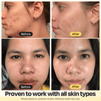 Gleamin Vitamin C Clay Mask — before-and-after results