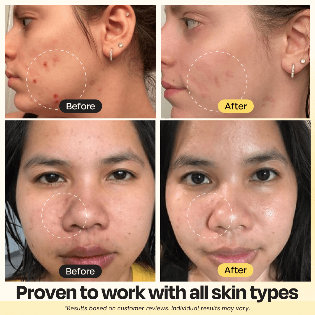 Gleamin Vitamin C Clay Mask — original 10-minute brightening clay mask