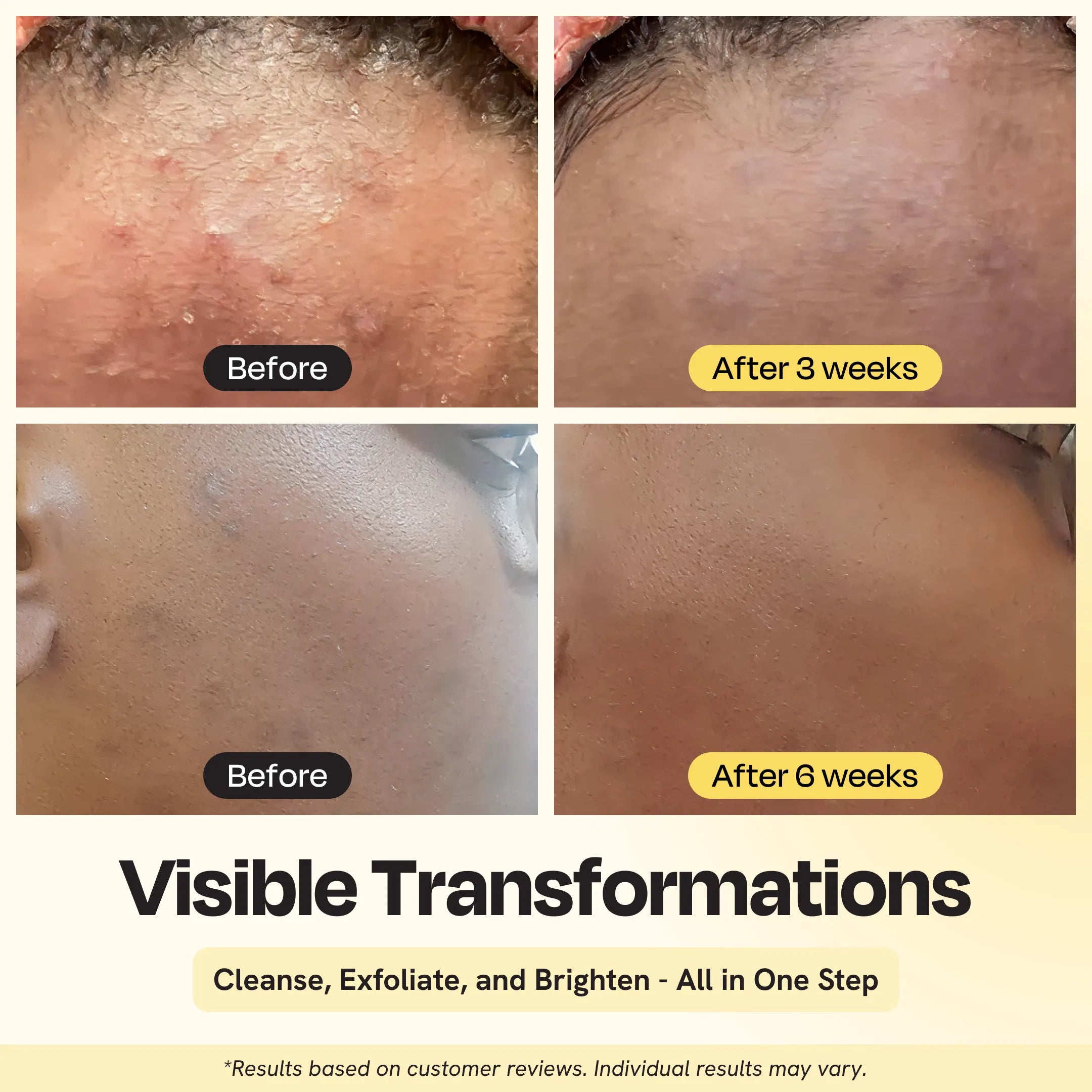 Gleamin Clarifying Brightening Cleanser — multi-active daily face wash