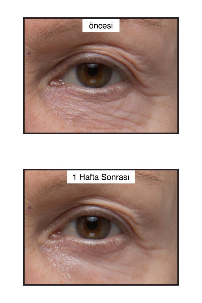 Murad Renewing Eye Cream 15ml - Anti-Aging Moisturizing Eye Cream for Fine Lines & Wrinkles