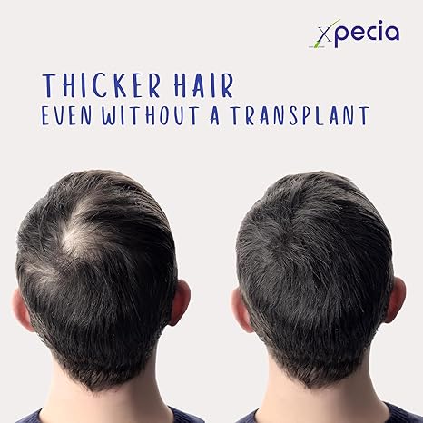 Xpecia For Men 60 Tablets - Hair Health Supplement | Men's Health