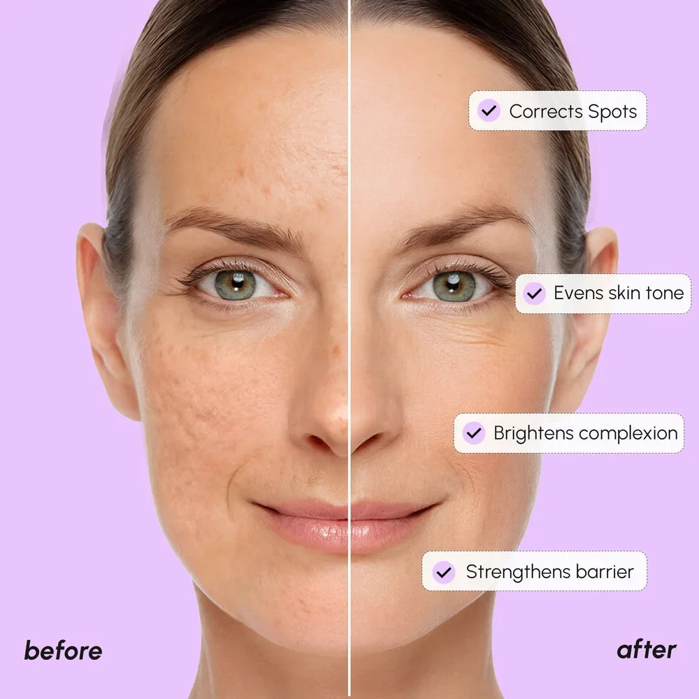 Dark Spot Corrector — view 4