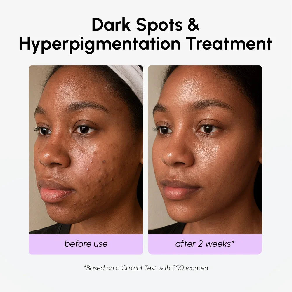 Dark Spot Corrector — view 5
