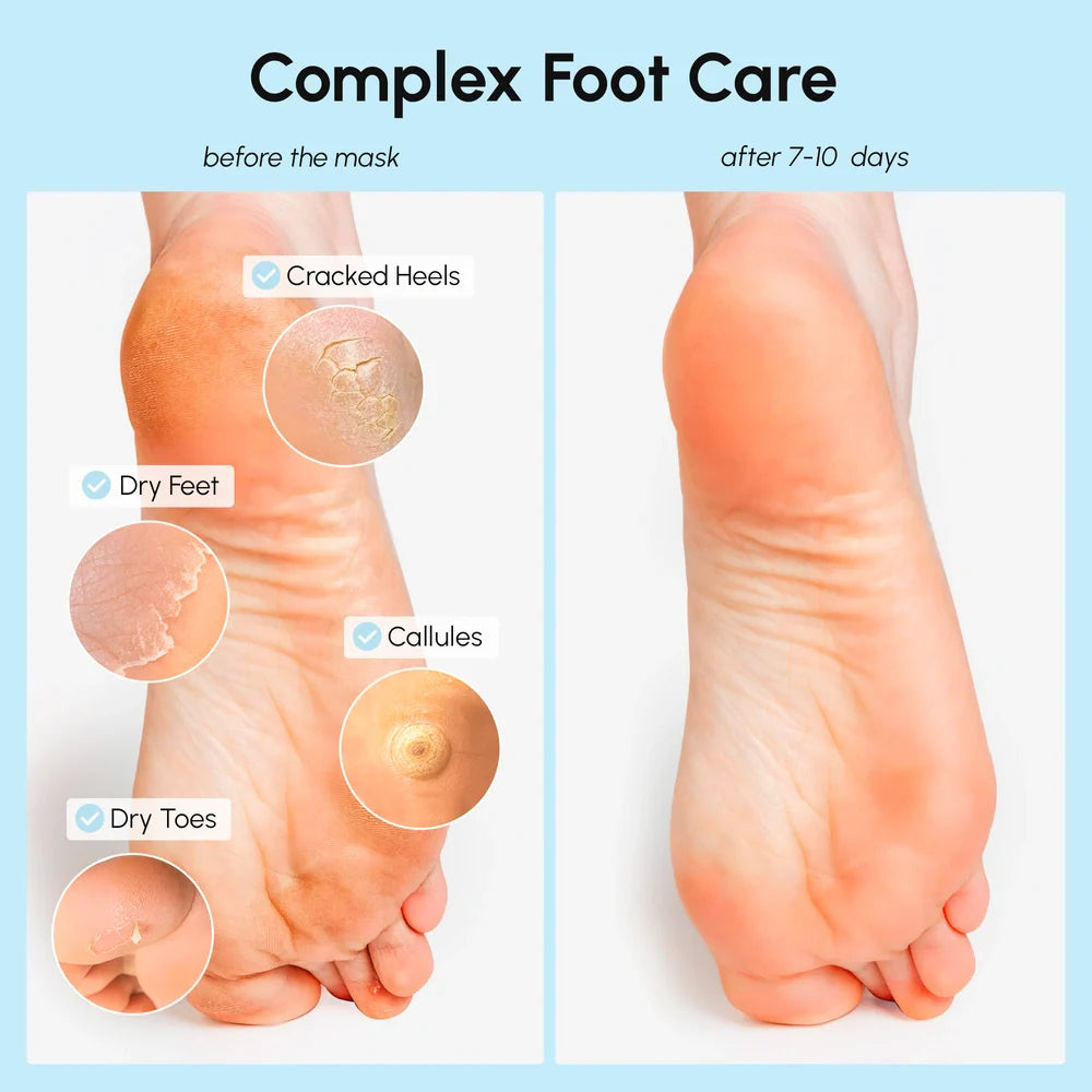 Maree Exfoliating & Hydrating Foot Mask — lifestyle context