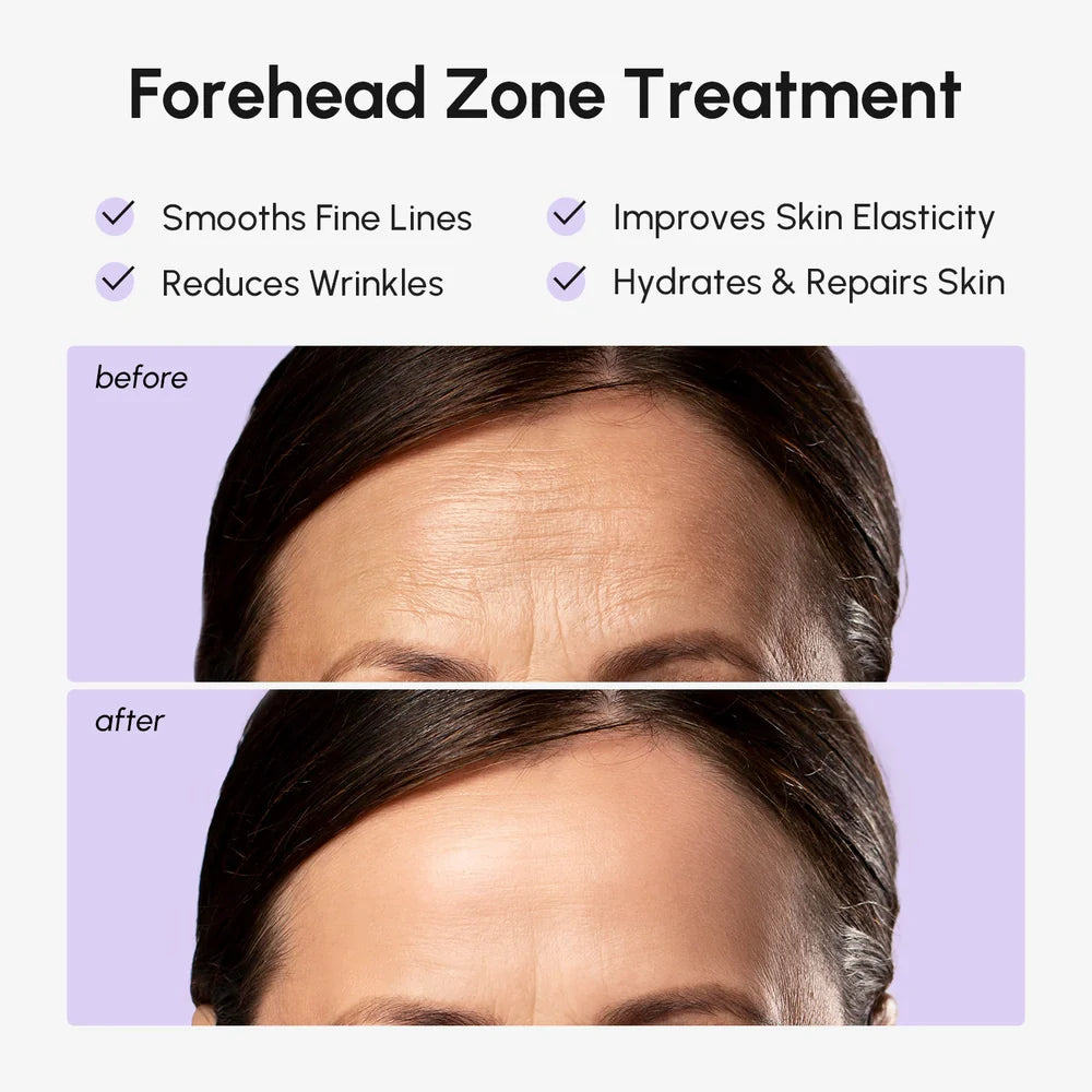Maree Anti-Wrinkle Forehead Patches — lifestyle context