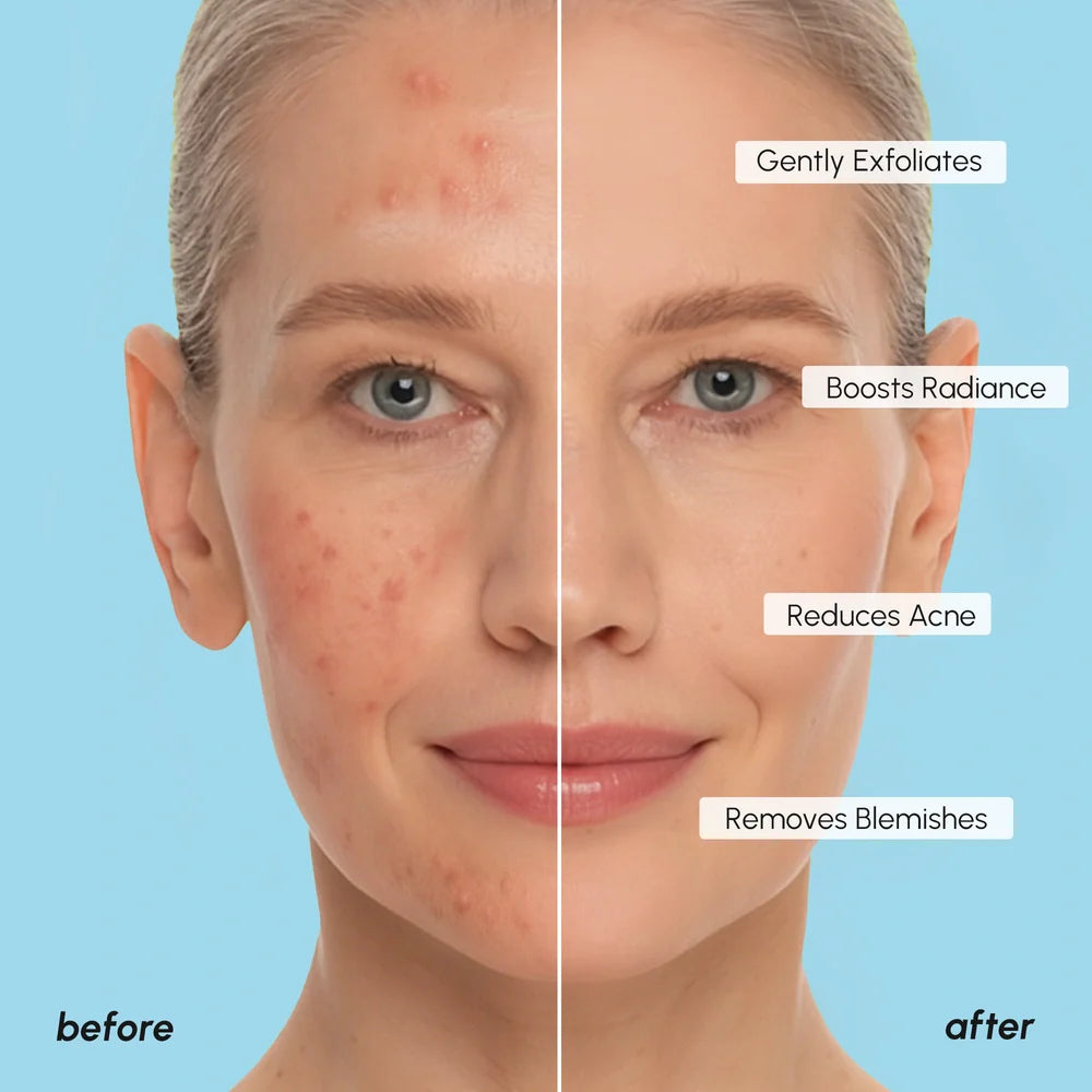 Maree Glycolic Acid Pads 200 PCS — in-use photo