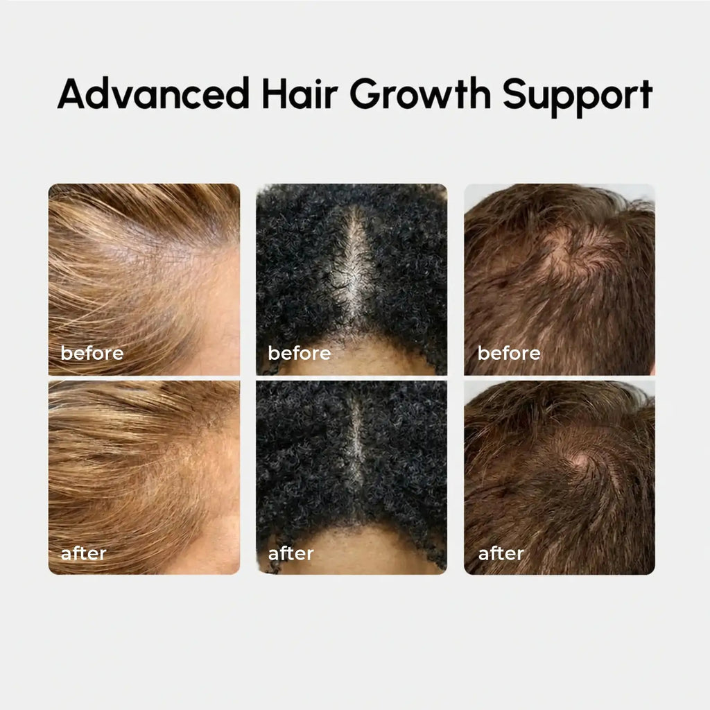 Maree 4-in-1 Hair Growth Spray — lifestyle context