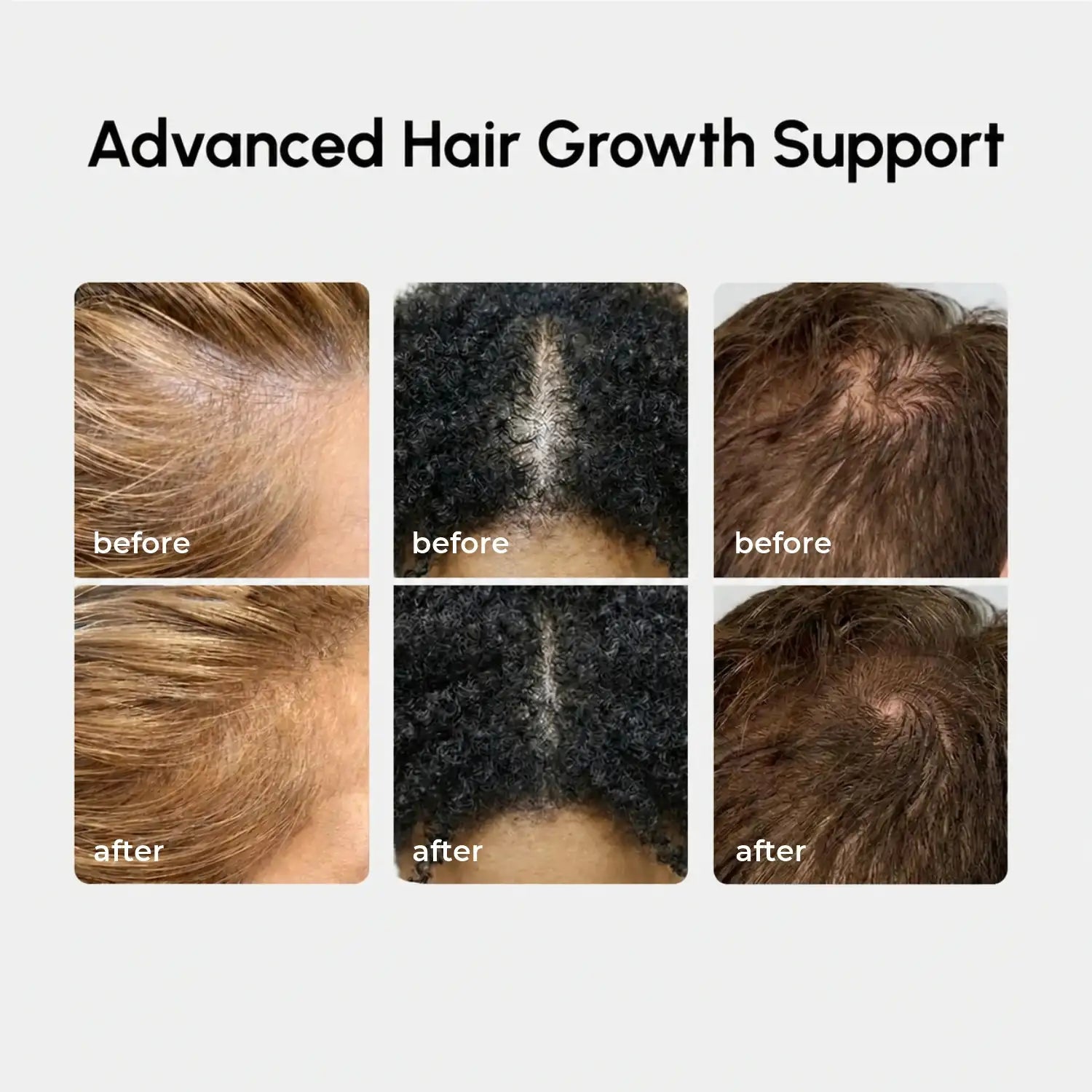 Maree 4-in-1 Hair Growth Spray — lifestyle context