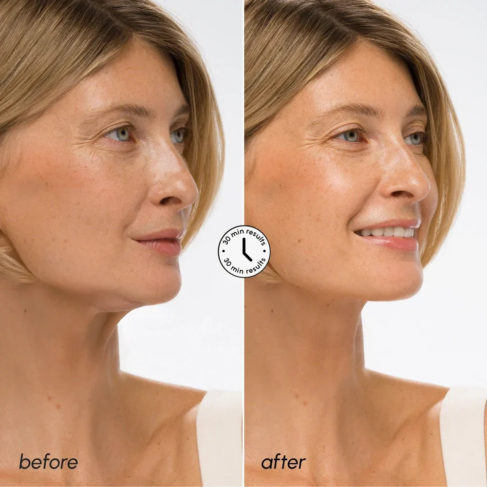 Maree Hyaluronic Acid V-line Lifting Mask — lifestyle context