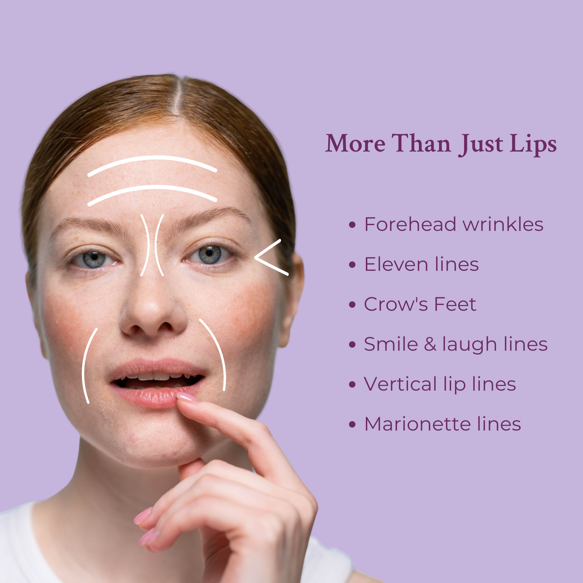 PRAI Beauty Ageless Lip & Line Filler — detail close-up