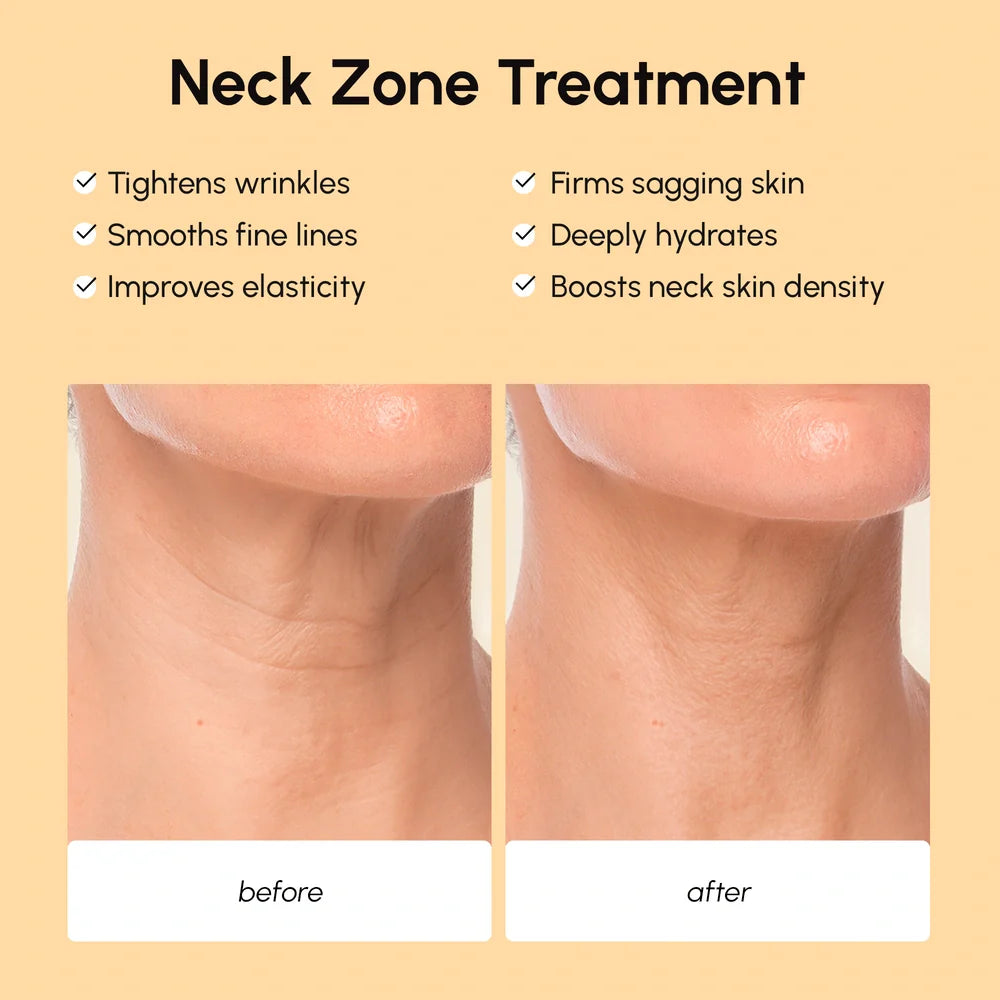 Maree Lifting Neck Wrinkle Patches — lifestyle context