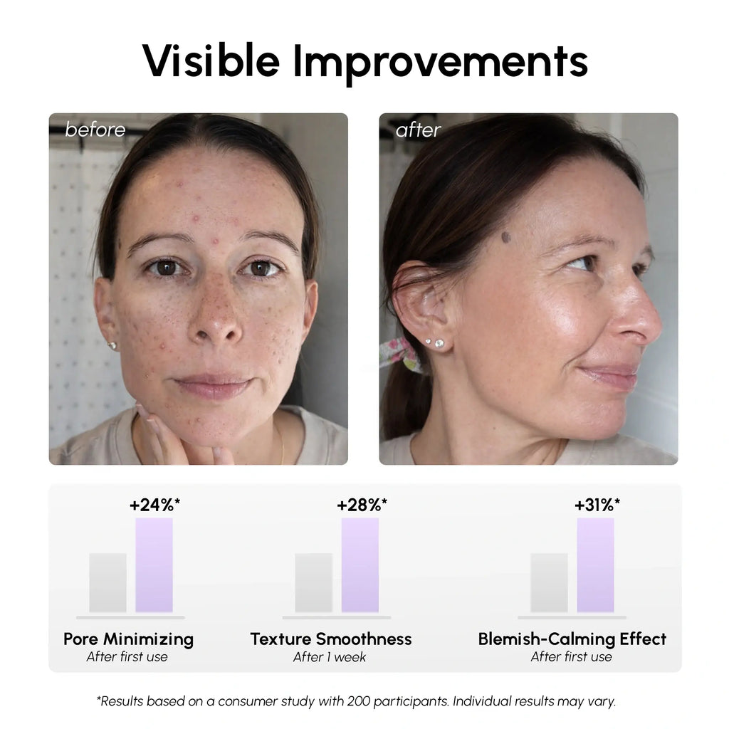 Maree 12% Niacinamide Smooth & Glow Pads — side view
