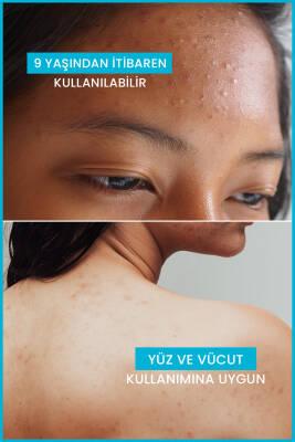 Ducray Keracnyl Foaming Gel 400ml - Acne Treatment Cleansing Gel for Oily Skin