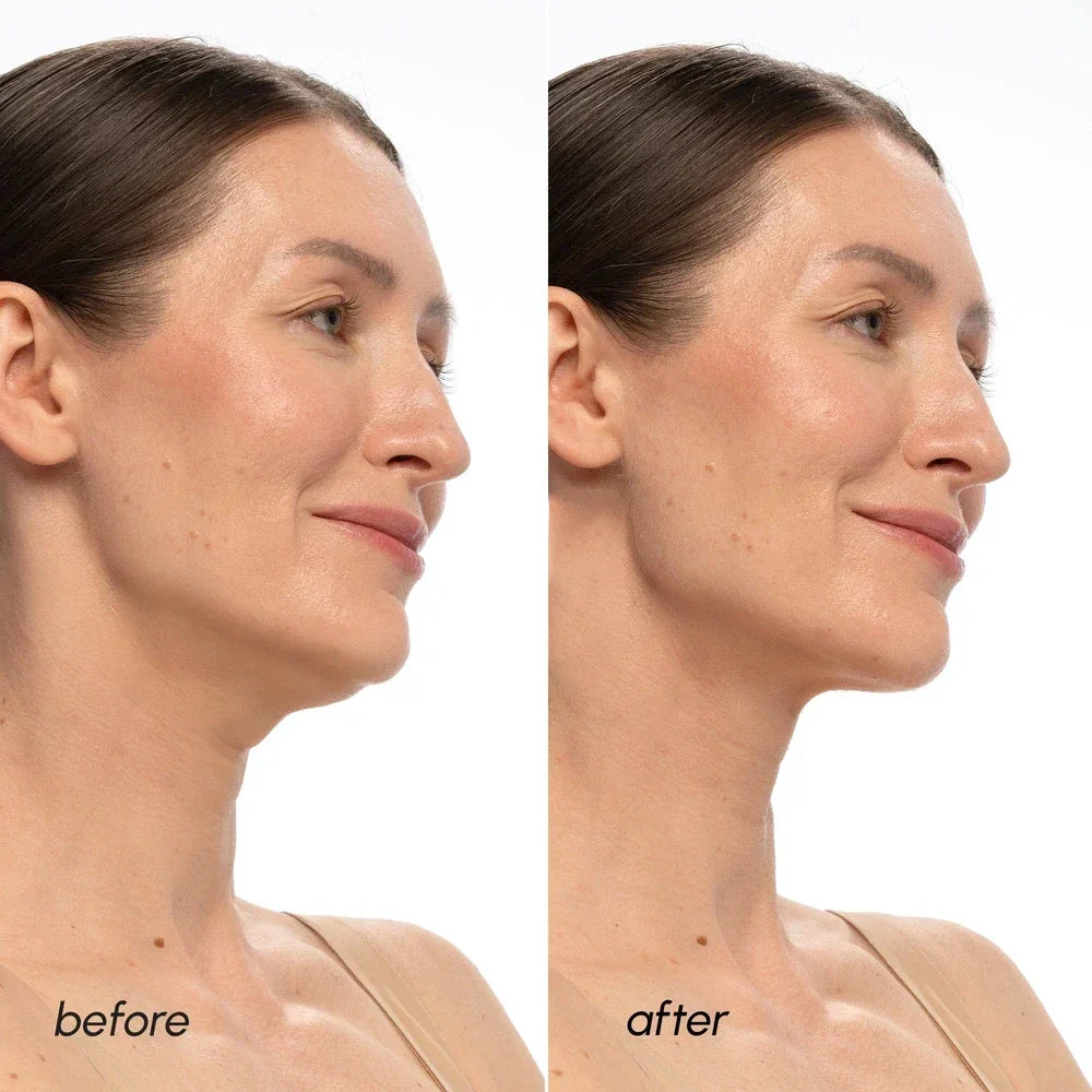 Maree PDRN V-line Lifting Mask — lifestyle context