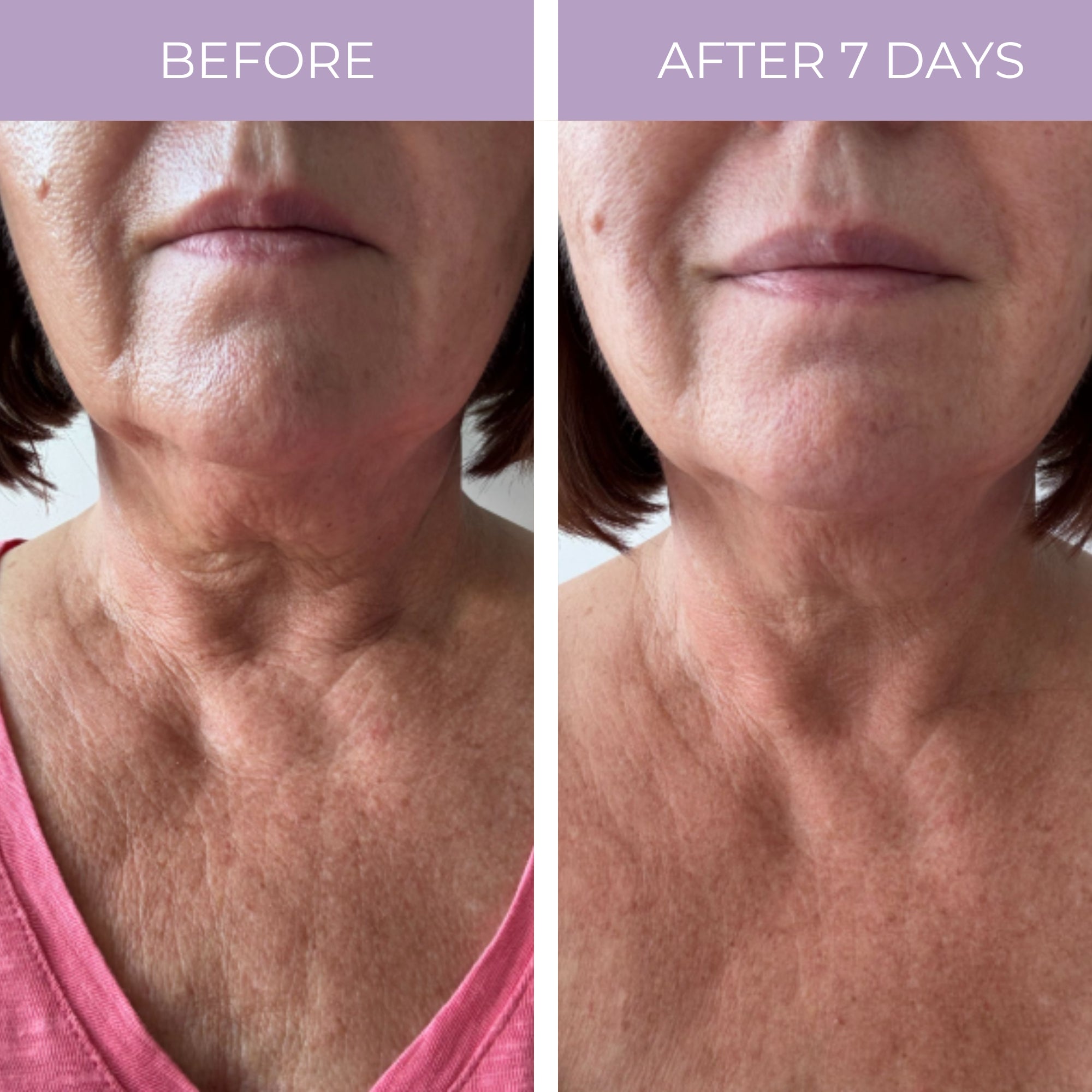 PRAI Beauty Ageless Throat & Decolletage Anti-Aging Neck Creme — side view