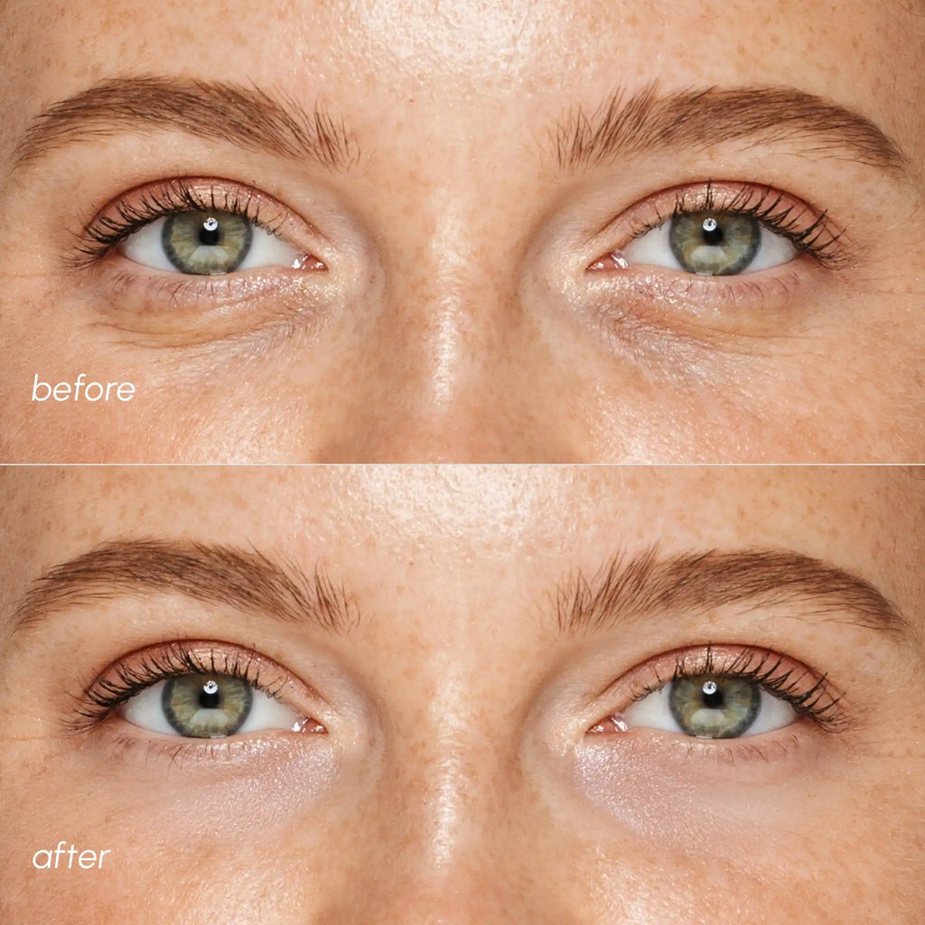 Maree Pink Eye Patches for Puffy Eyes — side view