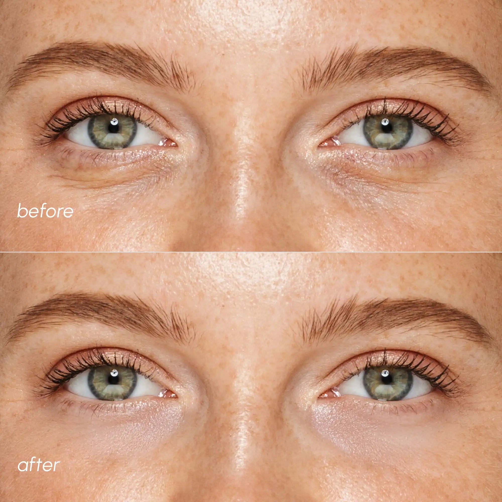 Maree Pink Eye Patches for Puffy Eyes — side view