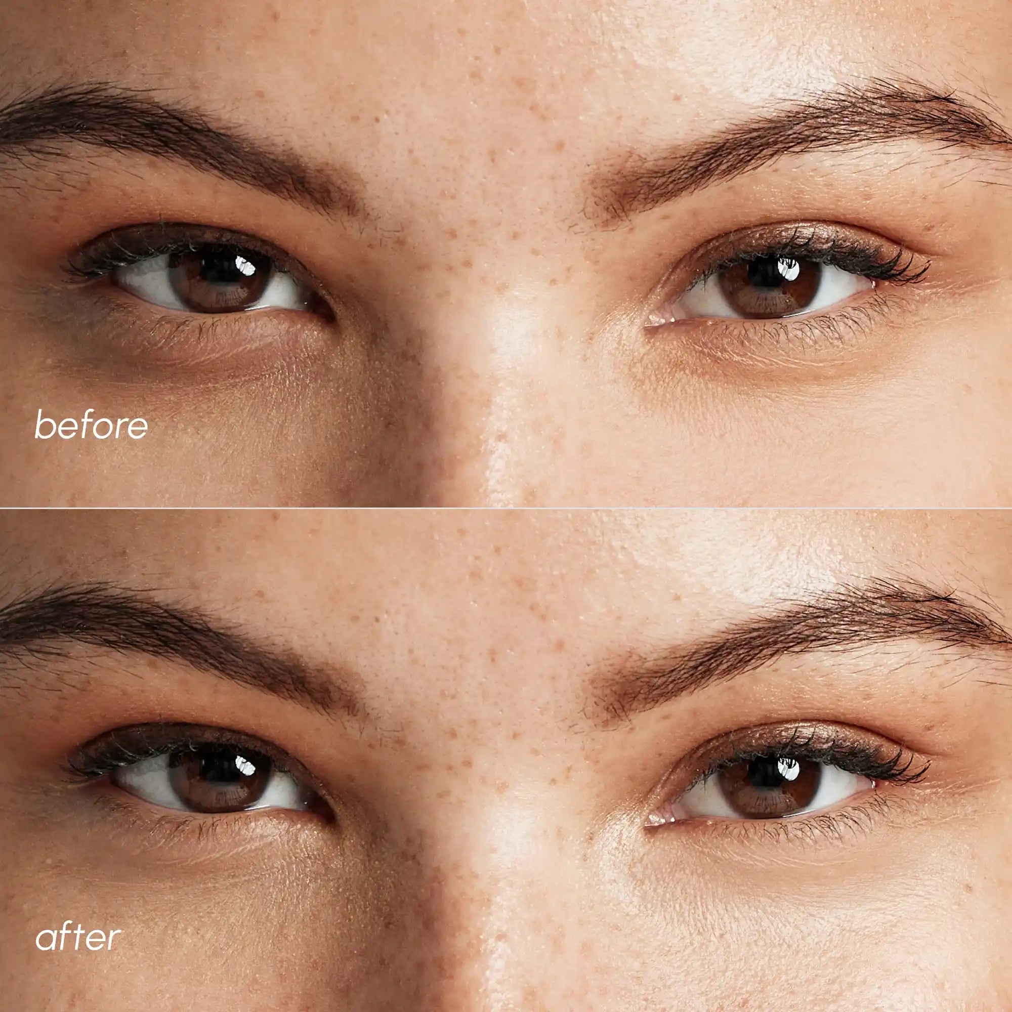 Maree Pink Eye Patches for Puffy Eyes — alternative angle